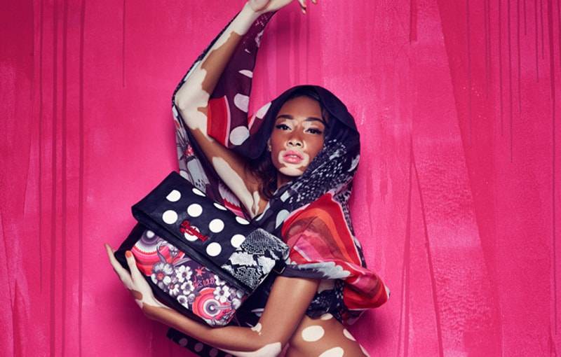 Desigual ficha a una modelo con vitíligo para su próxima campaña