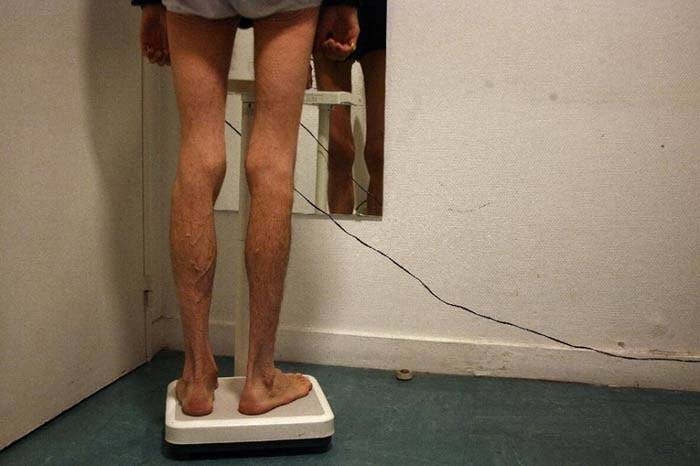 Former model holds fashion world accountable for anorexia