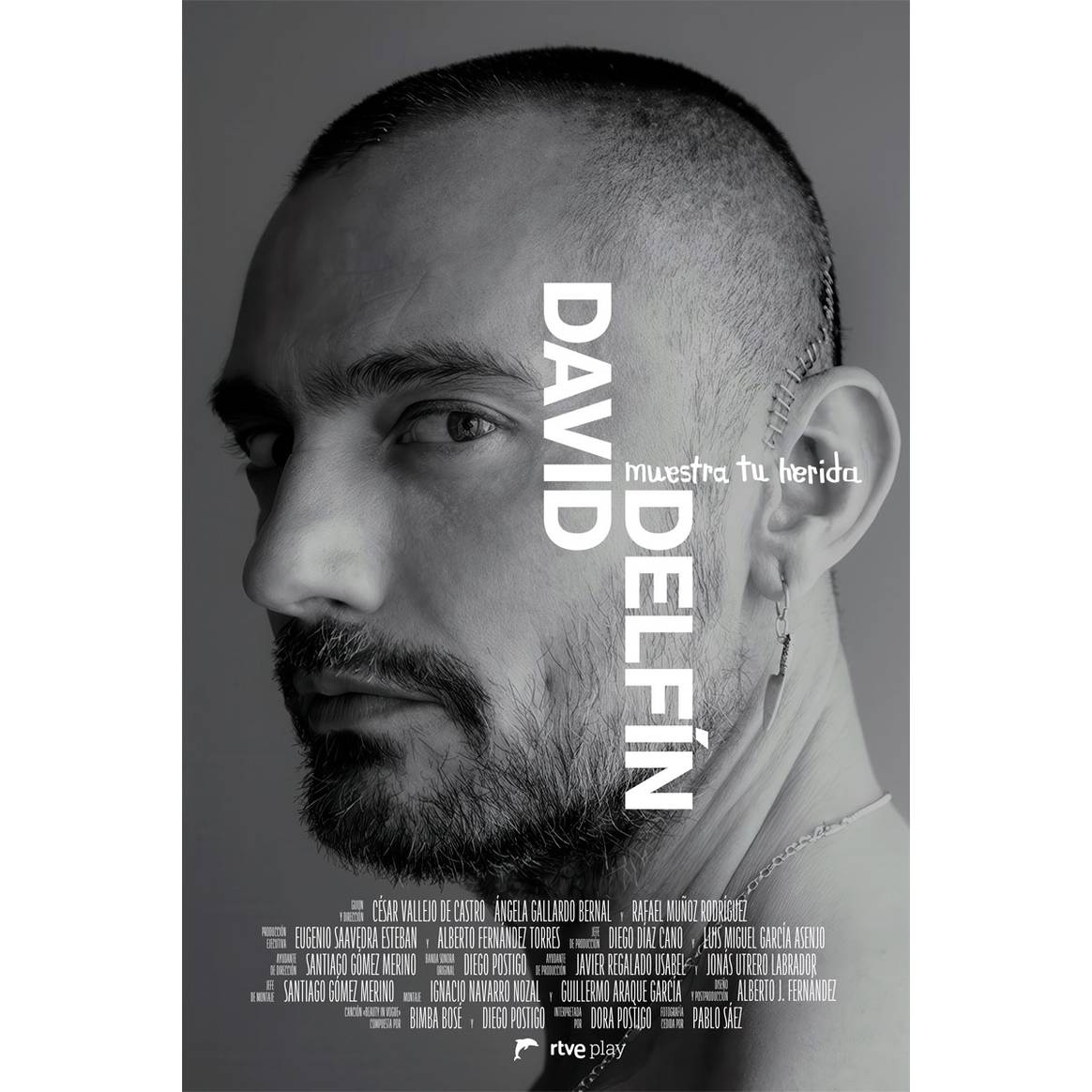 Cartel oficial del documental “David Delfín. Muestra tu herida”, obra de Pablo Sáez.