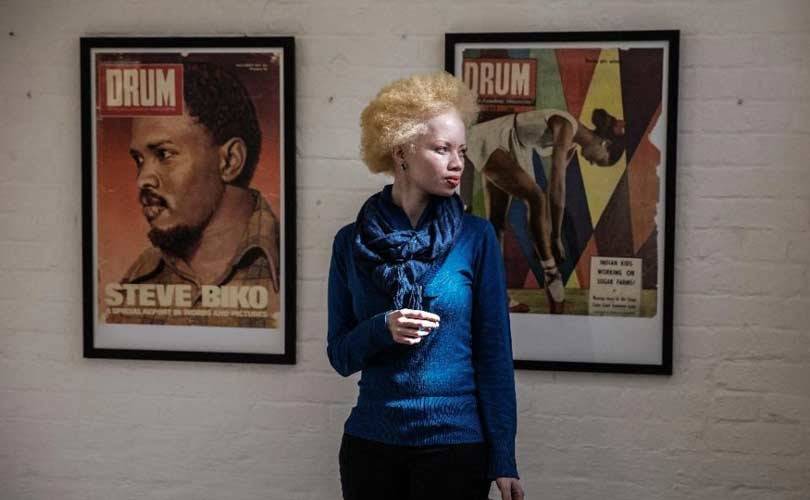 Thando Hopa, la lucha de la modelo albina suráfricana