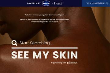 Vaseline launches platform aiming to improve skin healthcare for people of colour